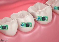 دندان مصنوعی بلوتوث دار تکنولوژی جدید